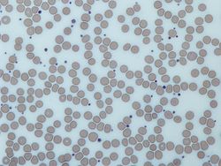General knowledge about Platelet